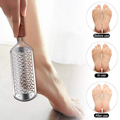2 Pieces Colossal Foot Rasp Foot Files Callus Remover Foot Scrubber, Stainless Steel Feet Grater Heel File Foot Pedicure Tools for Dry Cracked Heels - color: Foot Rasp X 2