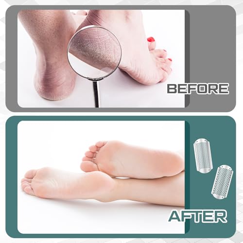 Moxweyeni 14 Pack Colossal Foot File Pedicure Tools Sets with 2 Styles Large and Small Hole Replacement Callus Remover Blades, Stainless Steel Detachable Pedicure Foot Rasp for Dead Skin Remover - color: Silver