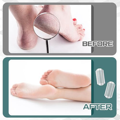 Moxweyeni 14 Pack Colossal Foot File Pedicure Tools Sets with 2 Styles Large and Small Hole Replacement Callus Remover Blades, Stainless Steel Detachable Pedicure Foot Rasp for Dead Skin Remover - color: Silver