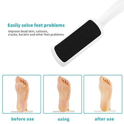 Foot File for Dead Skin - 3 Pack Professional Pedicure Tools Callus Remover for Feet, Dual-Sided Feet Scrubber Foot Care Products to Remove Callous Dead and Hard Skin for Both Wet and Dry Feet - size: 1 Count (Pack of 3)