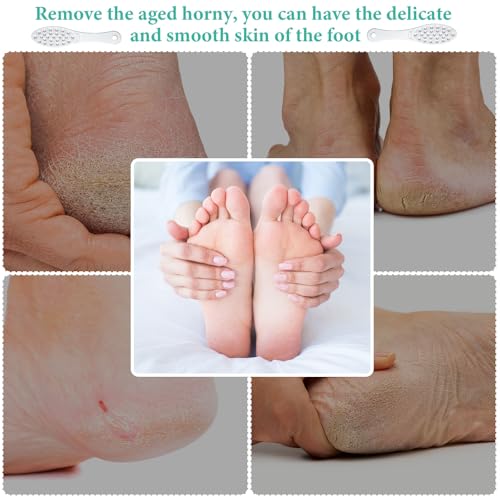2 Pcs Stainless Steel Foot Scraper Metal Foot File Double Sided File Callus Remover Professional Feet Rasp Scrubber for Wet or Dry Skin Easy to Clean Pedicure Tool Heel (Fresh Style) - size: Fresh Style