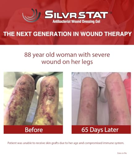 SilvrSTAT First Aid Kit Gel, 32 PPM Silver Healing Wound Dressing Gel, SilverSol Ag₄O₄ Particles, 1 oz - size: 1 Ounce