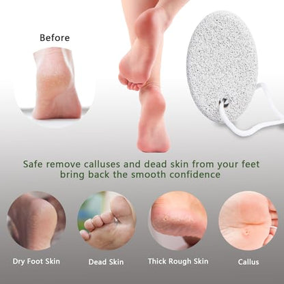 4-Pack Natural Pumice Stone for Feet, Borogo Lava Pedicure Tools Hard Skin Callus Remover for Feet and Hands - Natural Foot File Exfoliation to Remove Dead Skin, Heels, Elbows, Hands
