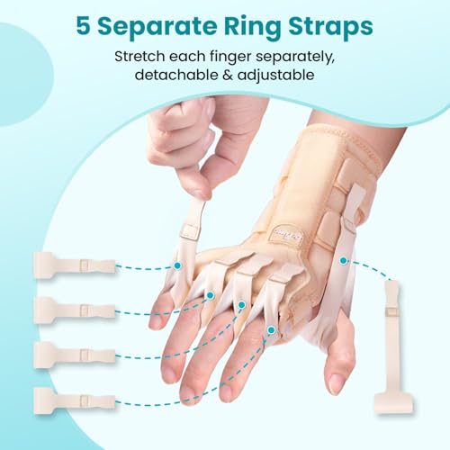 Radial Nerve Palsy Splint Brace for Wrist drop, 5 Fingers Extension, Stroke Patient Recovery, Finger Limp, Crutch Palsy, MCP Arthroplasty, for both Left and Right Hand - Beige - color: Beige