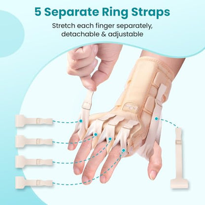 Radial Nerve Palsy Splint Brace for Wrist drop, 5 Fingers Extension, Stroke Patient Recovery, Finger Limp, Crutch Palsy, MCP Arthroplasty, for both Left and Right Hand - Beige - color: Beige