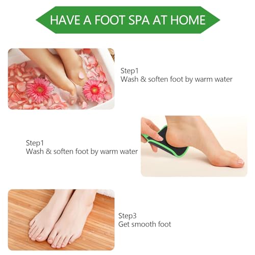 2 Pcs Curved Foot File Callus Remover for Feet, Double Sided Heel File Scraper U Shaped Foot Scrubber Dead Skin Remover - color: Green&yellowish