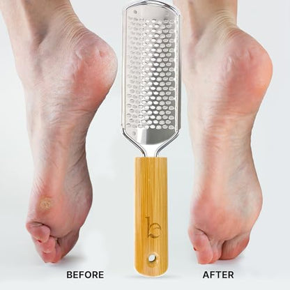 Foot File - Callus Remover Tool for Dead Skin Removal | At Home Pedicure Tools, Foot Rasp Callus Remover Feet and Heels