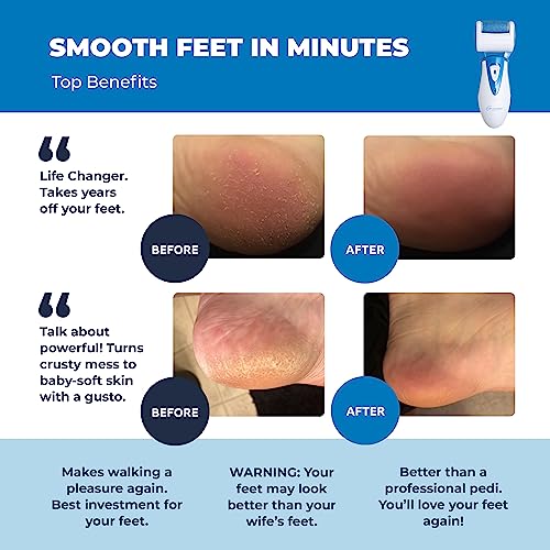 Electric Callus Remover: Rechargeable Electronic Foot File CR900 by Own Harmony (Powerful Motor) Best Pedicure Tools w 3 Rollers Professional Pedi Feet Care Sander for Cracked Heels and Hard Skin - color: Blue