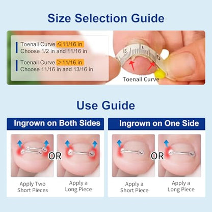 Nitinol Ingrown Toenail Corrector,at Home Ingrown Toenail Treatment,Curved Toenail Straightener,Ingrown Toe Nail Relief，Ingrown Toenail Removal Kit (11/16 In,13/16 In) - size: 11/16 In,13/16 In
