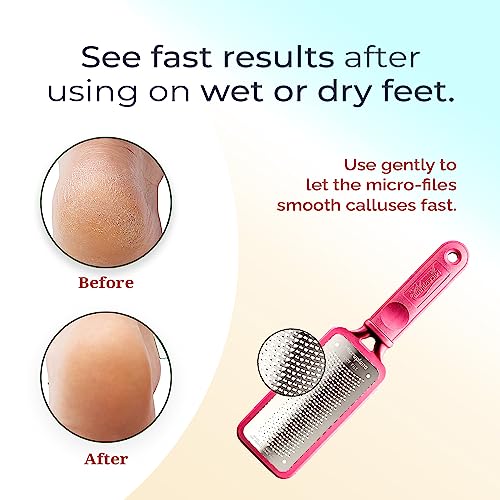 Microplane Colossal Foot File Scraper - The Original Stainless Steel Foot Rasp, Dead Skin/Callus Remover for Feet, Gentle Foot Scrubber, Pedicure Tools for Salon-Quality Foot Care, Pink - style: Pink