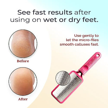 Microplane Colossal Foot File Scraper - The Original Stainless Steel Foot Rasp, Dead Skin/Callus Remover for Feet, Gentle Foot Scrubber, Pedicure Tools for Salon-Quality Foot Care, Pink - style: Pink