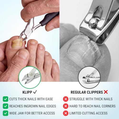 Toenail Clippers for Thick Toenails – KLIPP 15 mm Wide Jaw Thick Fingernail and Toenail Cutter with Curved Stainless-Steel Blades for Seniors (Eagle Beak) - size: Eagle Beak