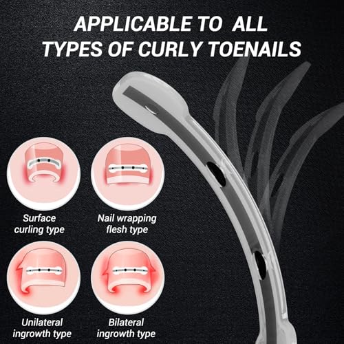 Titanium Alloy Ingrown Toenail Treatment, Nail Tools, and Ingrown Toenail Removal Kit Specially Designed for Curved Nail Repair and Ingrown Toenail Corrector (0.67/0.79in) - size: 0.67/0.79in