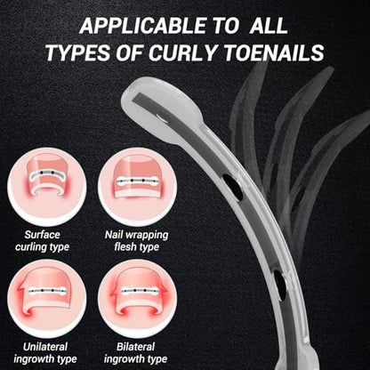 Titanium Alloy Ingrown Toenail Treatment, Nail Tools, and Ingrown Toenail Removal Kit Specially Designed for Curved Nail Repair and Ingrown Toenail Corrector (0.67/0.79in) - size: 0.67/0.79in