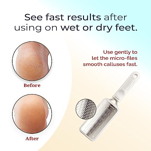 Microplane Colossal Foot File Scraper - The Original Stainless Steel Foot Rasp, Dead Skin/Callus Remover for Feet, Gentle Foot Scrubber, Pedicure Tools for Salon-Quality Foot Care, White - style: White