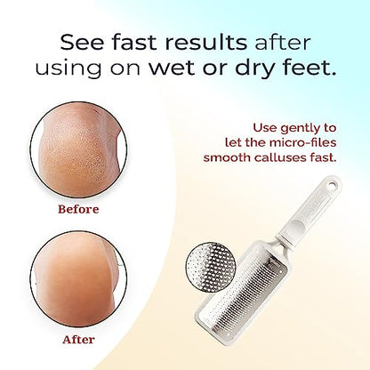 Microplane Colossal Foot File Scraper - The Original Stainless Steel Foot Rasp, Dead Skin/Callus Remover for Feet, Gentle Foot Scrubber, Pedicure Tools for Salon-Quality Foot Care, White - style: White