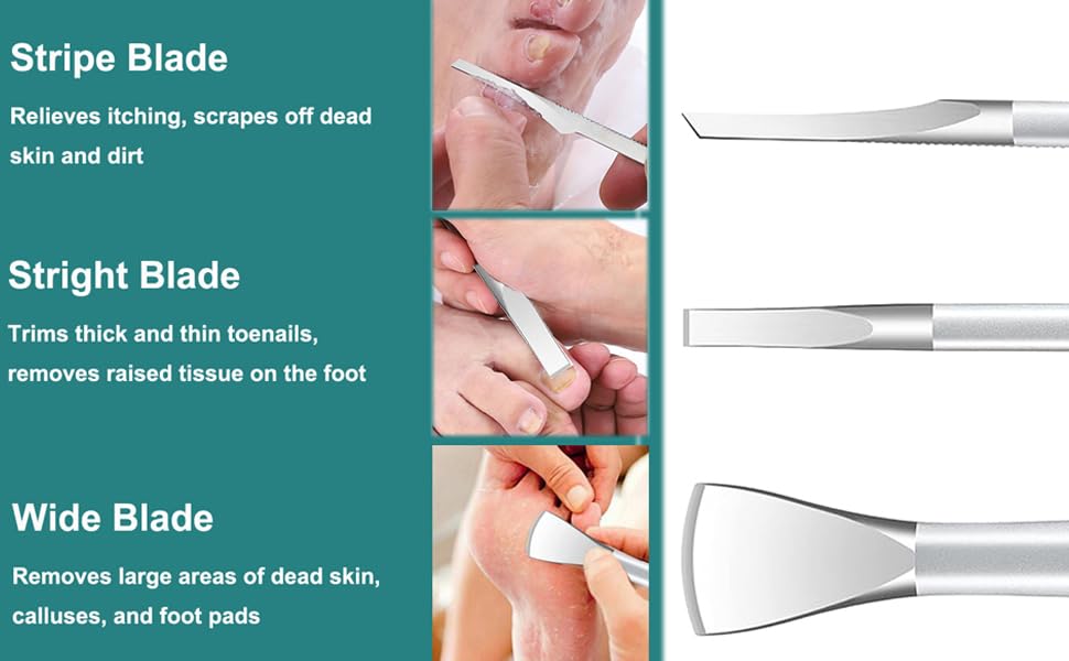 Ingrown Toenail Removal Kit, Pedicure Tools Kit Professional Knife Set Stainless Steel Ingrown Toenail Tool Foot Care Tools Nail Cuticle Remover (5 Pcs Set) - color: 5 Pcs Set