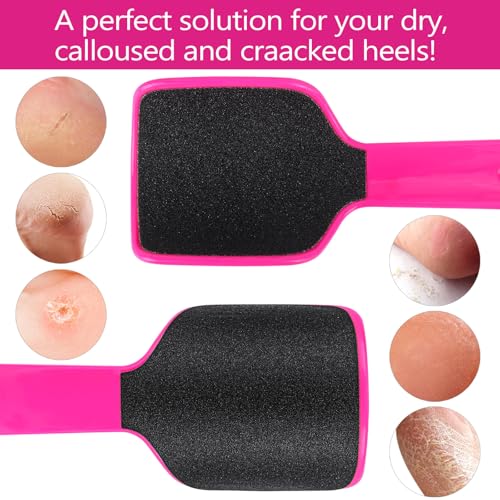 2 Pcs Curved Foot File Callus Remover for Feet, U Shaped Foot Scrubber Dual Sided Heel File Scraper Dead Skin Remover - color: Rose Pink&yellowish