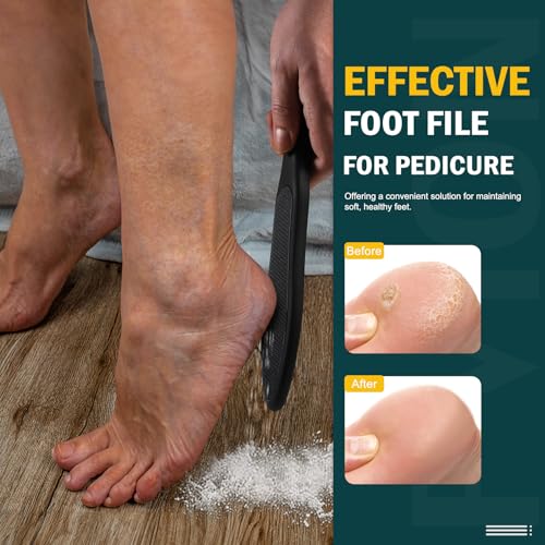 FVION Double-Sided Nano Glass Foot File for Callus Remover - Highly Effective Hard and Dead Skin Remover for Cracked Heels and Dry Skin (Black) - color: Black