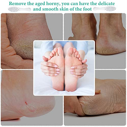 1 Pcs Stainless Steel Foot File Callus Remover Double Sided Metal Foot Scraper Rasp Scrubber for Wet or Dry Skin Professional Pedicure Tool for Hard Skin Cracked Heels Feet (Classic Style) - size: 1 Count (Pack of 1)