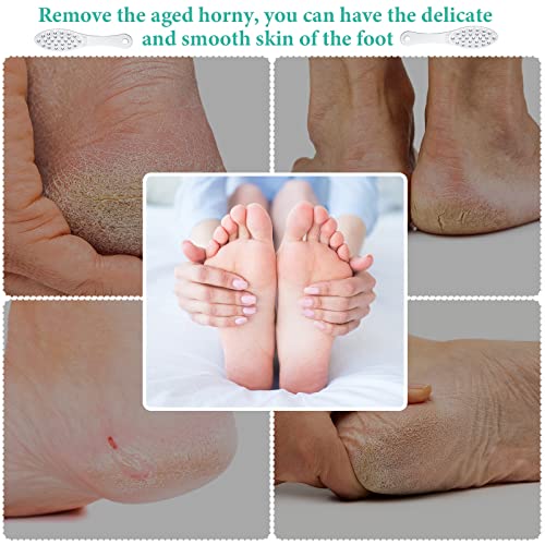 2 Pcs Stainless Steel Foot File Callus Remover Double Sided Metal Foot Scraper Rasp Scrubber for Wet or Dry Skin Professional Pedicure Tool for Hard Skin Cracked Heels Feet (Classic Style) - size: 1 Count (Pack of 2)