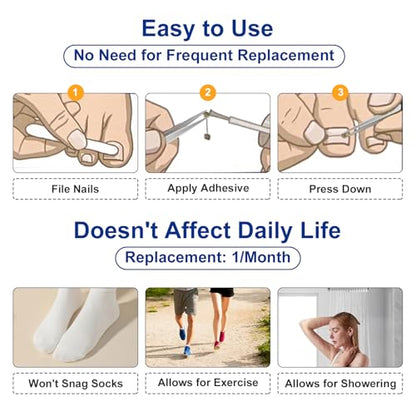 Nitinol Ingrown Toenail Corrector,at Home Ingrown Toenail Treatment,Curved Toenail Straightener,Ingrown Toe Nail Relief，Ingrown Toenail Removal Kit (11/16 In,13/16 In) - size: 11/16 In,13/16 In