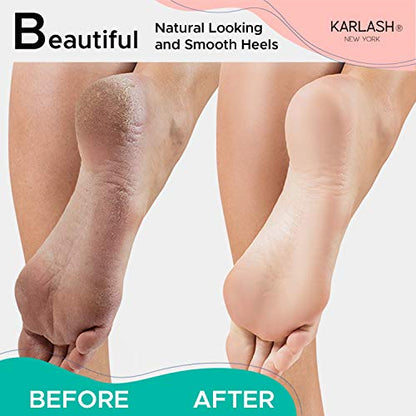 Karlash 2-Sided Nickel Foot File for Callus Trimming and Callus Removal, Mint (1)