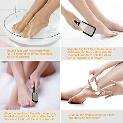 Foot File Callus Remover,Colossal Foot Rasp and Professional Foot Scrubber Pedicure Kit to Remove Hard Skin for Wet and Dry Feet,Surgical Grade Stainless Steel File (black and silvery)