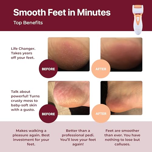 Rechargeable Callus Remover for Feet: Professional Electric Feet Sander for Women by Own Harmony - Electronic Foot File CR900 with 3 Rollers, Foot Grinder Pedi Care for Cracked Heels & Dry, Hard Skin - color: Peach