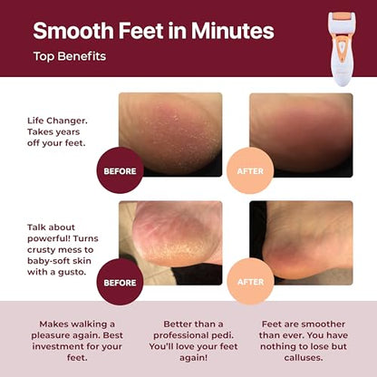 Rechargeable Callus Remover for Feet: Professional Electric Feet Sander for Women by Own Harmony - Electronic Foot File CR900 with 3 Rollers, Foot Grinder Pedi Care for Cracked Heels & Dry, Hard Skin - color: Peach