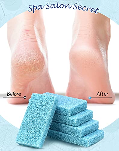 Maryton Disposable Foot Scrubber Pumice Pads, Pedicure Pumice Stone Dead Skin Callus Remover for Feet, 40Pcs (Blue Medium Coarse) - style: Blue Medium Coarse