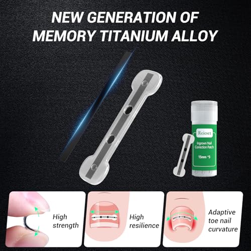 Titanium Alloy Ingrown Toenail Treatment, Nail Tools, and Ingrown Toenail Removal Kit Specially Designed for Curved Nail Repair and Ingrown Toenail Corrector (0.67/0.79in) - size: 0.67/0.79in