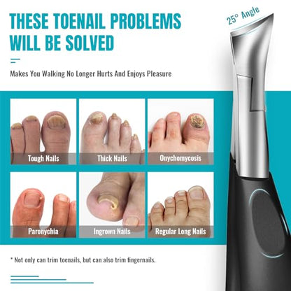 Toenail Clippers for Thick Nails for Seniors - Heavy Duty Toe Nail Clippers Kit with Long Handle for Men & Elderly with Inflexible Joints, Professional Nail Clippers Kit for Thickened Toenails (Black) - style: Creating Exquisite Nails - Black