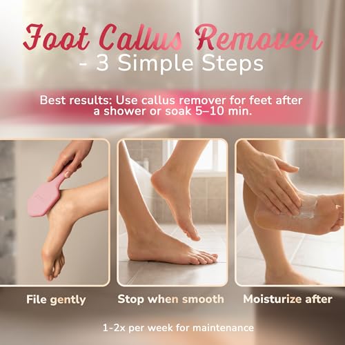 SILKLE Nano Glass Foot File - Foot Callus Remover for Feet & Foot Scrubber | Silicone Grip for Non-Slip Control - Foot Scrubber for Dead Skin, Heel Scraper for Cracked Heels & Foot Exfoliator - Pink - style: Pink