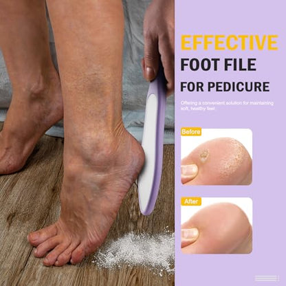 FVION Double-Sided Nano Glass Foot File for Callus Remover - Highly Effective Hard and Dead Skin Remover for Cracked Heels and Dry Skin (Purple) - color: Purple