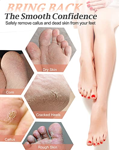 Maryton Natural Pumice Stone for Feet - Lava Foot Exfoliator Scrubber Pedicure Tools, Dead Skin Corn Callus Remover for Feet and Hands, 1 Count - style: 1pcs Pumice Stone