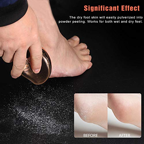BEZOX Glass Foot File Callus Remover, Crystal Pedicure Foot Scrubber for Travel Use, Portable Handheld Sized Foot Scraper for Cracked Heel - Shinning Golden - style: Shinning Golden