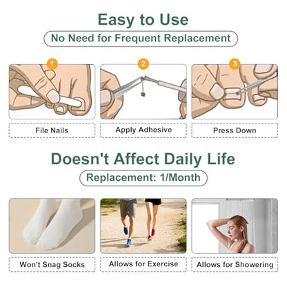 Dual Nitinol Ingrown Toenail Corrector,Ingrown Toenail Treatment,Curved Toenail Straightener,Ingrown Toenail Removal Kit,Big Toe Ingrown Toenail Tool (0.55in,0.66in) - size: 0.55in,0.66in