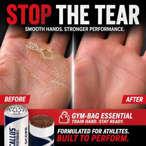 Hand Callus Shaver & 2 Smoothers | Precision Removal Tool for Weightlifters & Functional Fitness | Safe Alternative to Razors | Prevent Rips - style: Score Bundle with Additional Smoothing caps