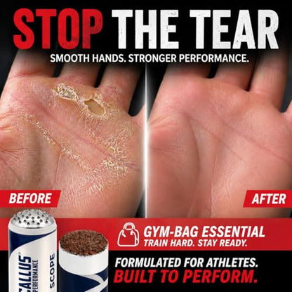 Ultimate Bundle: Precision Remover, Healing Salve & 2 Smoothers | Hand Care System for Weightlifting, Gymnastics & Functional Fitness | Prevents Rips when training - style: Ultimate Bundle