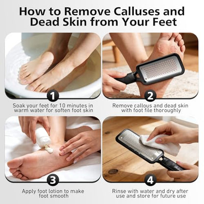 BALUCA Professional Foot File & Callus Remover - Stainless Steel Foot Rasp & Metal Feet Scrubber, Pedicure Tool for Hard Skin & Dead Skin Removal, Cracked Heel Repair for Baby Soft Feet (Black) - color: Black