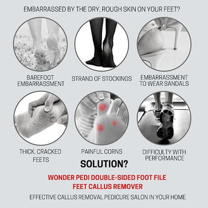 Made in Germany Double Sided Metal Foot File - Stainless Steel Feet Callus Remover - Feet Scrubber Dead Skin - Heel Scraper Cracked Heels Repair Professional Foot Rasp. - style: Stainless Steel