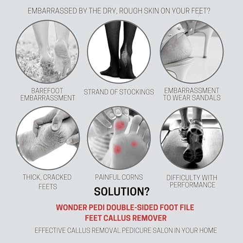 Made in Germany Ceramic Stone and Stainless Steel Foot File, Double Sided Callus Remover, Feet Scrubber, Professional Pedicure Foot Care Tool Rasp, Long Lasting Foot Buffer, Heel Scraper, Wonder Pedi - style: Classic