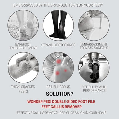 Made in Germany Ceramic Stone and Stainless Steel Foot File, Double Sided Callus Remover, Feet Scrubber, Professional Pedicure Foot Care Tool Rasp, Long Lasting Foot Buffer, Heel Scraper, Wonder Pedi - style: Classic