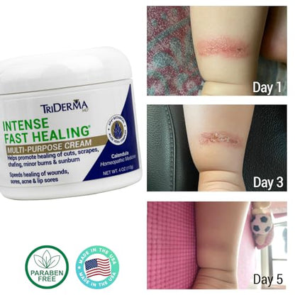 TriDerma Intense Fast Healing Cream, Decreases Healing Time for Minor Irritations, Rashes, Scrapes, Cuts 4 Ounces - size: 4 Ounce (Pack of 1)