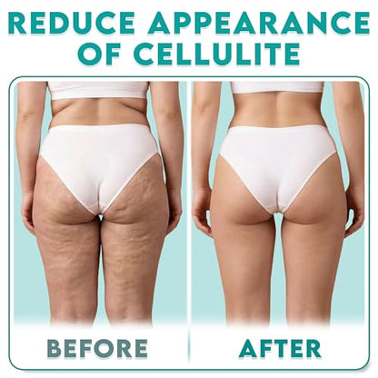 COZLOW - MyoRelease Lymphatic Drainage Massager - Yellow - Handheld Fascia Release + Scar Tissue Massage Roller for Shoulder, Neck, Belly, Thigh, Leg, Back, Glutes - Helps Reduce Cellulite Appearance - color: Yellow