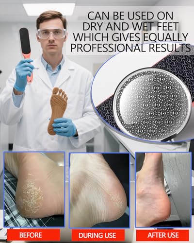 Nano Glass Foot File, Callus Remover for Feet, Wet and Dry Feet Dead Skin Remover, Durable Foot Scrubber, Double-Sided Safe Hygienic Pedicure Tools for Feet, Long Lasting Foot Care Soft Smooth Feet - style: Rose gold