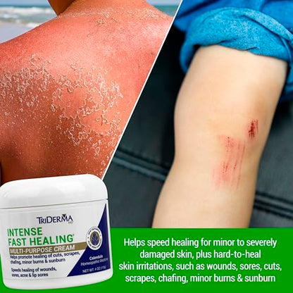 TriDerma Intense Fast Healing Cream, Decreases Healing Time for Minor Irritations, Rashes, Scrapes, Cuts 4 Ounces - size: 4 Ounce (Pack of 1)