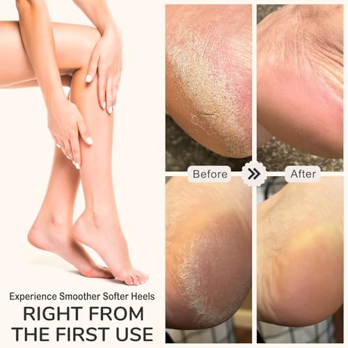 HANMU Dual-Sided Foot File & Toe Callus Remover Set - Durable Foot Scrubber | Smooths hands, feet, toes & cracked heels. Removes rough dead skin. Wet or dry use. Salon at home hygienic pedicure tool