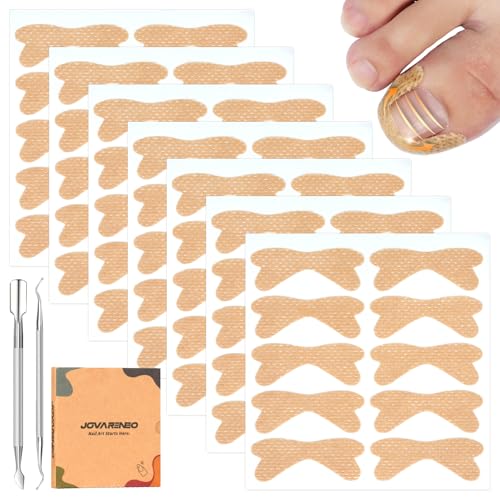 Ingrown Toenail Treatment, 60Pcs Breathable Curved Ingrown Toenail Corrector Strips with File & Lifter, Painless Professional Ingrown Toenail Correction Patches for Fast Results - color: Skin Color